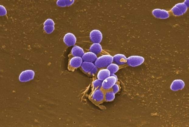 Enterococcus
