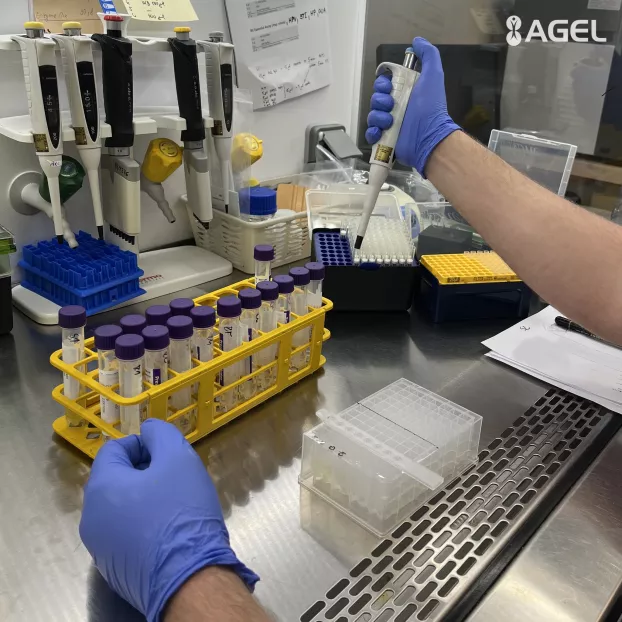   Speciális laboratóriumi módszerekkel kivizsgáltatható a bélférgesség