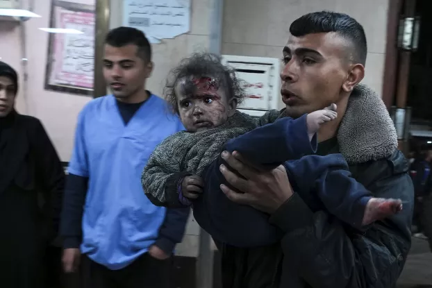 Gázai sebesült gyerek