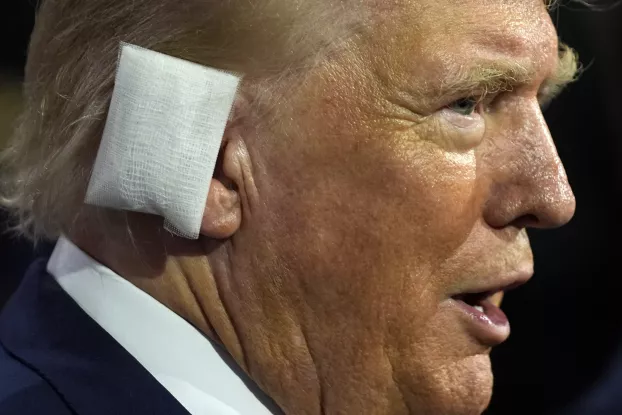 Donald Trump fülkötés