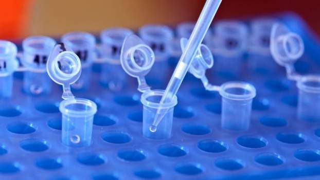 201712131528100.dna-labor-.jpg