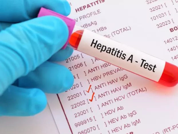 hepatitis A, sárgaság