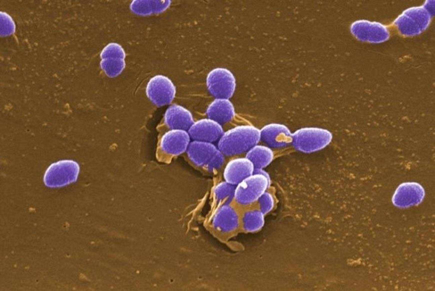 Enterococcus