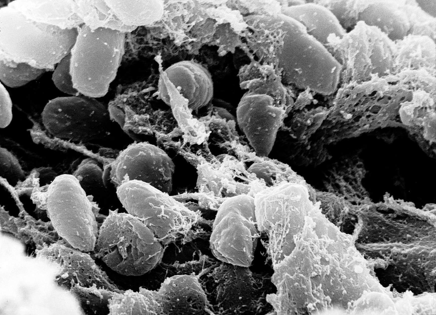 pestisbakteriumok elektronmikroszkop alatt
