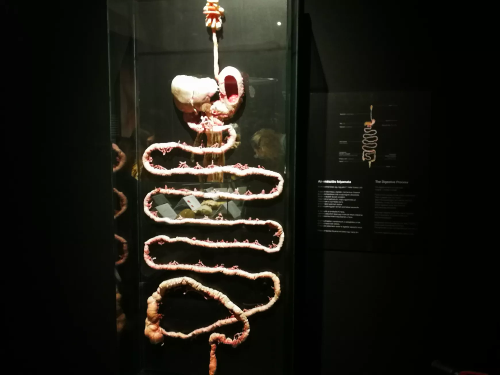 Félidőben a Magyarországon először látható BODY WORLDS kiállításról