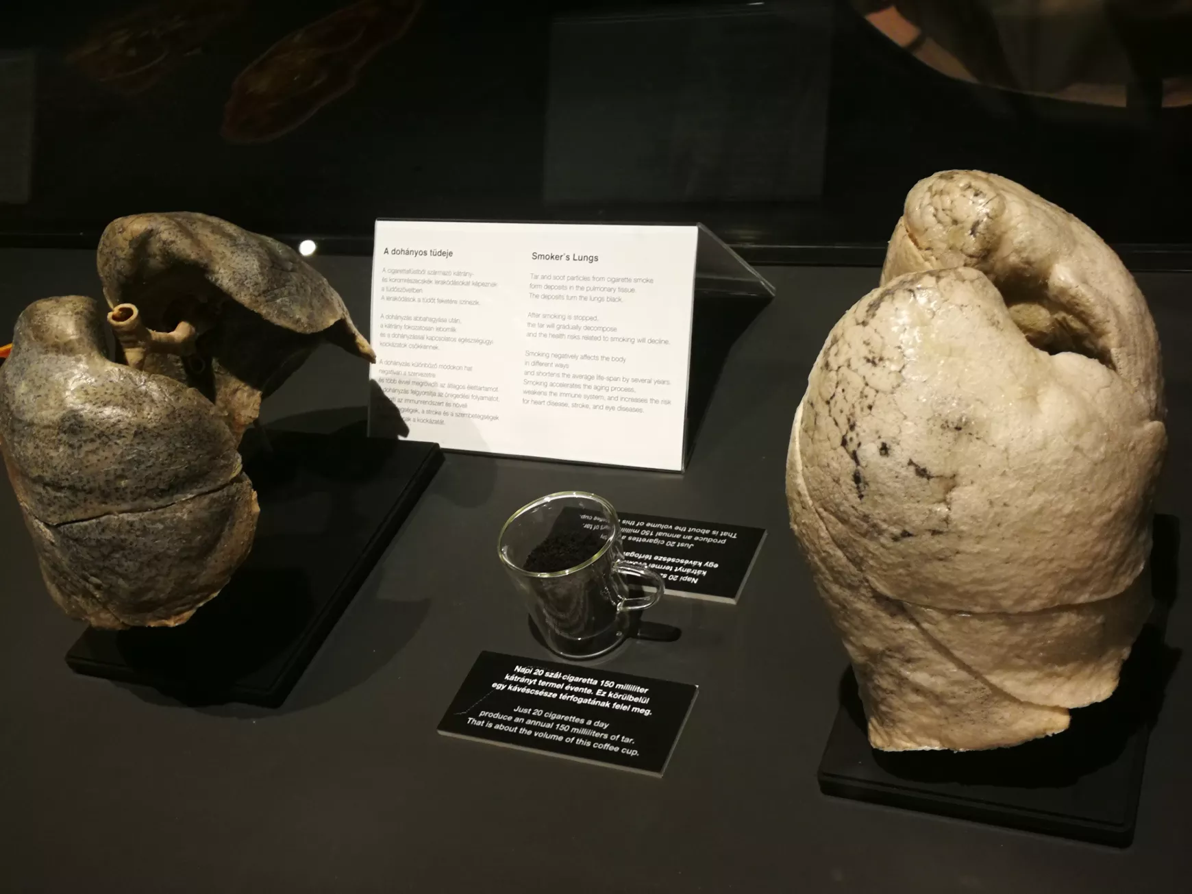Félidőben a Magyarországon először látható BODY WORLDS kiállításról