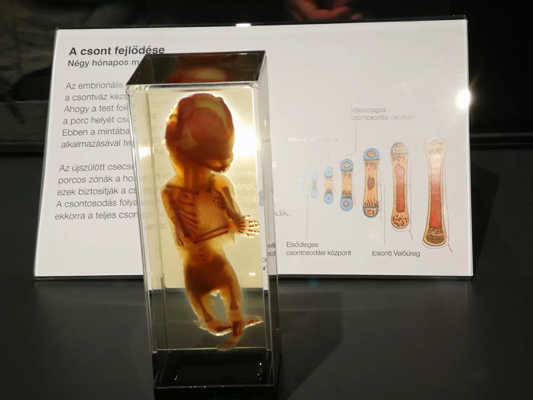 Félidőben a Magyarországon először látható BODY WORLDS kiállításról