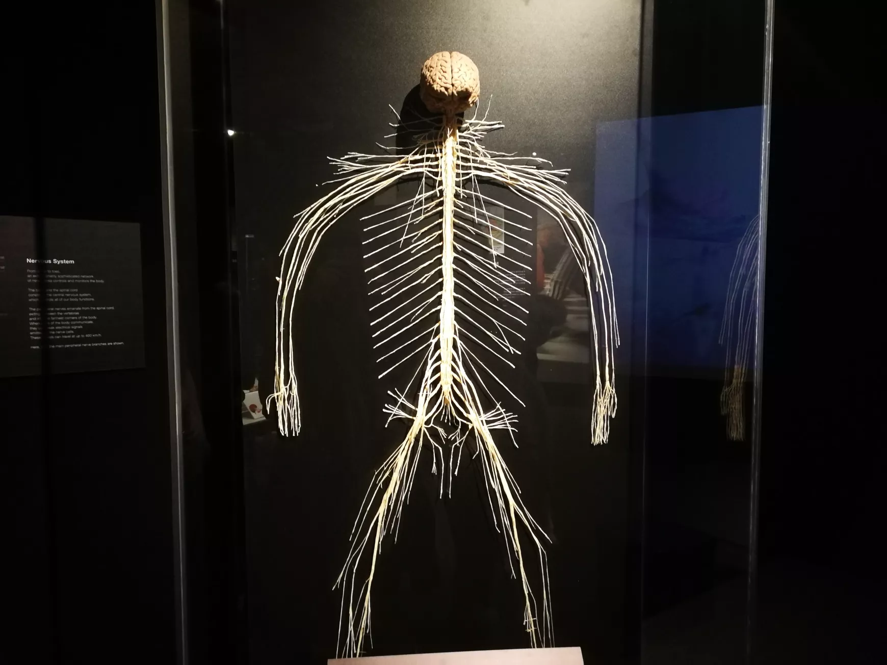 Félidőben a Magyarországon először látható BODY WORLDS kiállításról