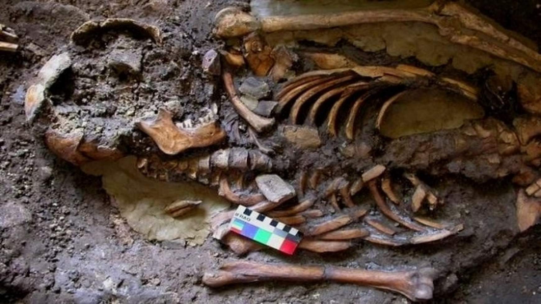 201511162229230.SKELETON_2.jpg 201511162229230.SKELETON_2.jpg