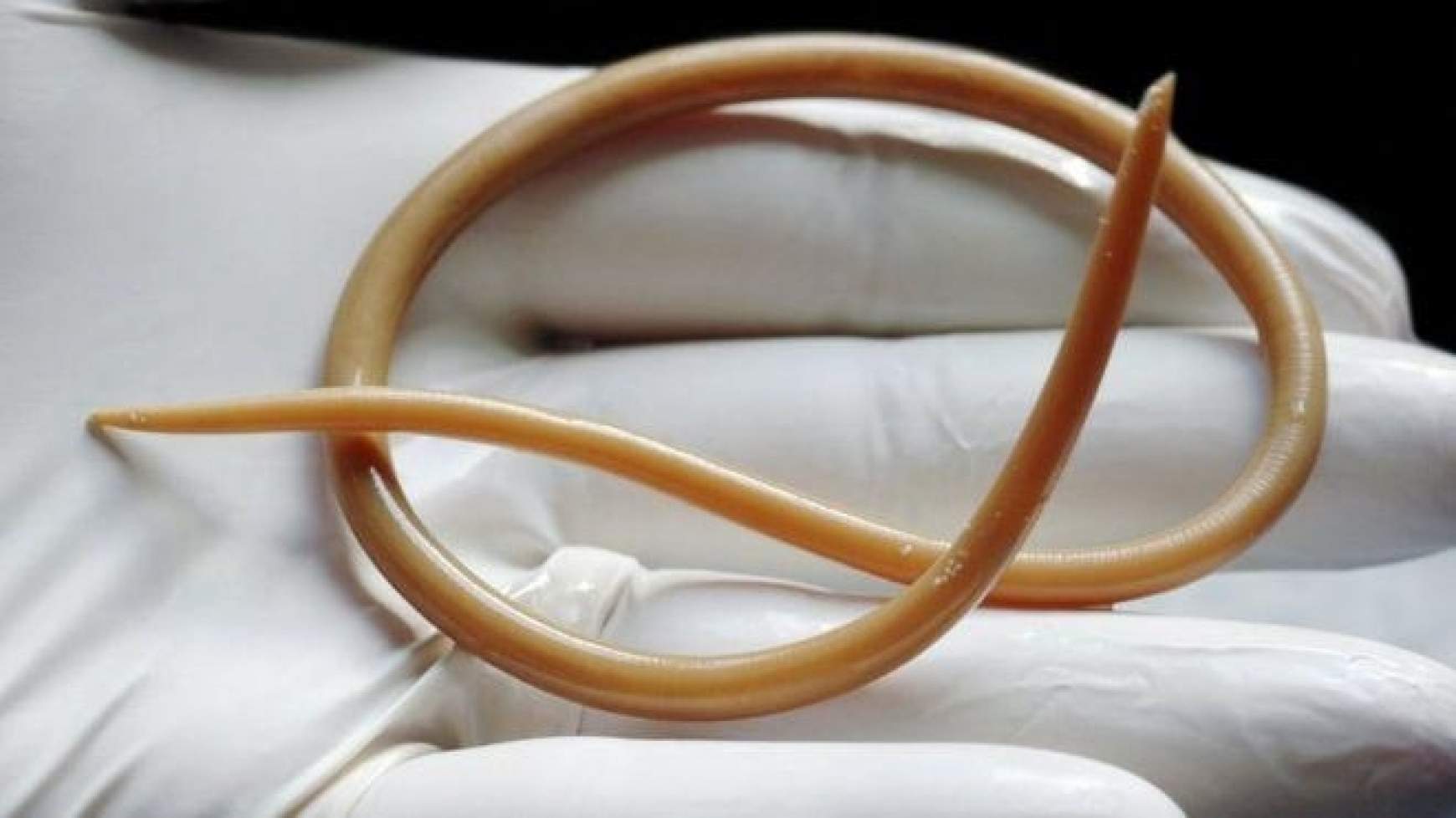 201511201713060.263-parasitic_roundworm-spl.jpg