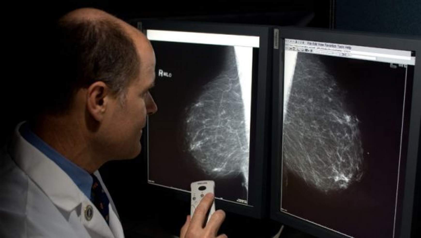 mammografia.jpg