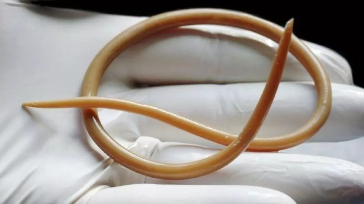 201511201713060.263-parasitic_roundworm-spl.jpg